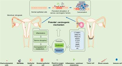 A Review of the Clinical Characteristics and Novel Molecular Subtypes of Endometrioid Ovarian Cancer